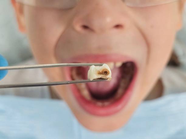 Best Emergency Treatment for Jaw Pain or Injury in Montrose, NY