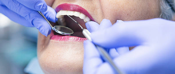 Best Emergency Denture Repair in Montrose, NY